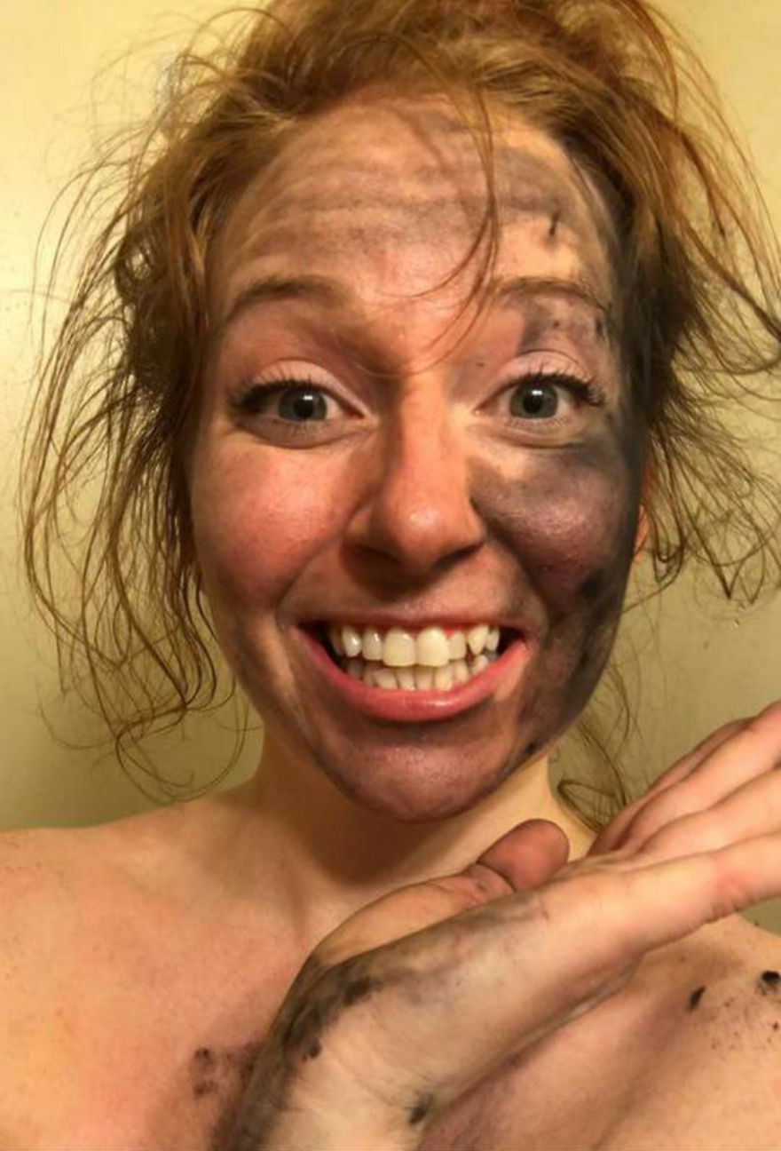Daughter's Diy Teeth Whitening Experience! Daughter's Diy Teeth Whitening Experience!
