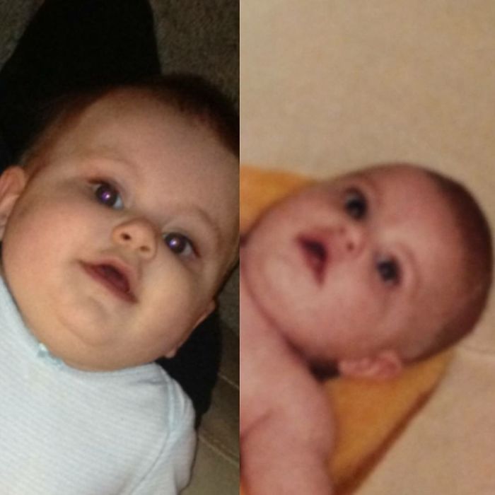 Daughter On The Left Father On The Right Both At 8 Months Old