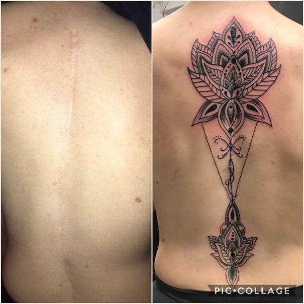 A Recent Tattoo I Did Covering A Large Surgery Scar