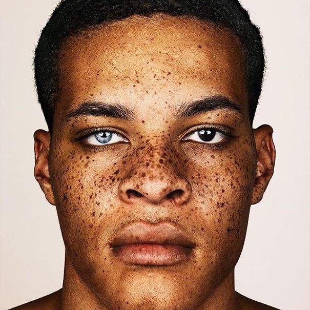 This Photographer Amazingly Captures The Uniqueness Of Exposed Faces