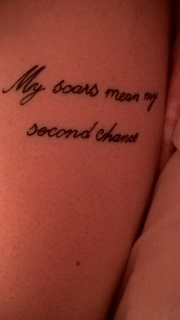 My Scars Mean My Second Chance And They Really Do