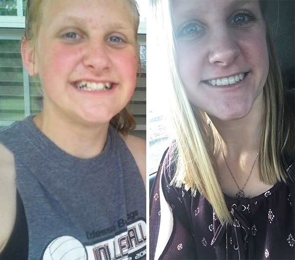 Just Want To Thank The Man Who Invented Braces