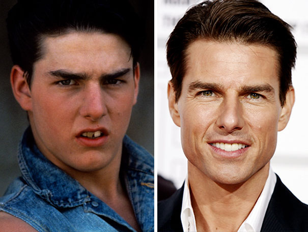 Tom Cruise Had A Remarkable Transformation