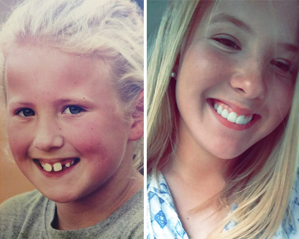 I'd Like To Thank Jesus And All Those Years Of Braces For This
