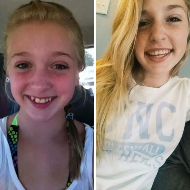 This Smile Transformation