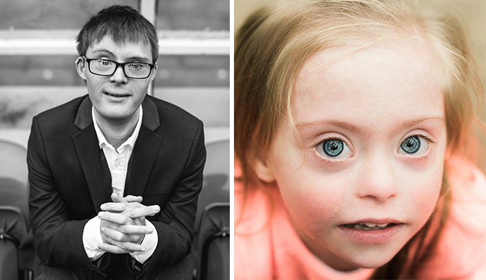 This Is Me: We Photographed People Beyond Their Disabilities