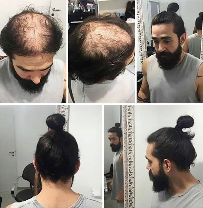 Jangan terlalu ketat mengikat rambut