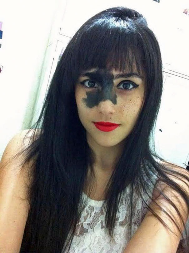 Girl Who Was Told That Her Rare Birthmark Looks Ugly Chose Not To Remove It, And Here's Why
