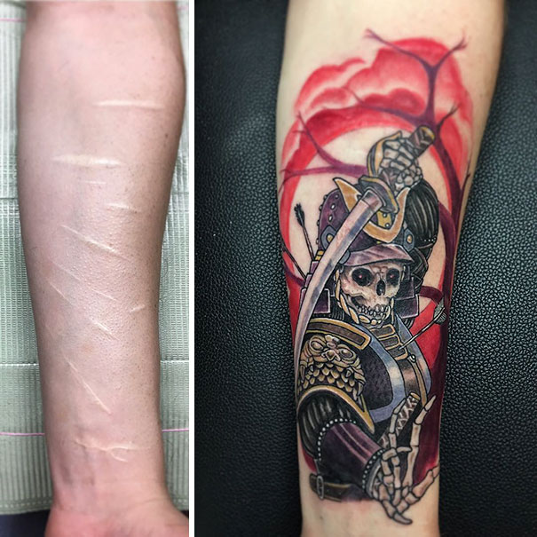 Scars Tattoo Cover Up