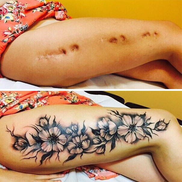 Cutting Scars  Tattoo Cover Ups  Dr Davin Lim