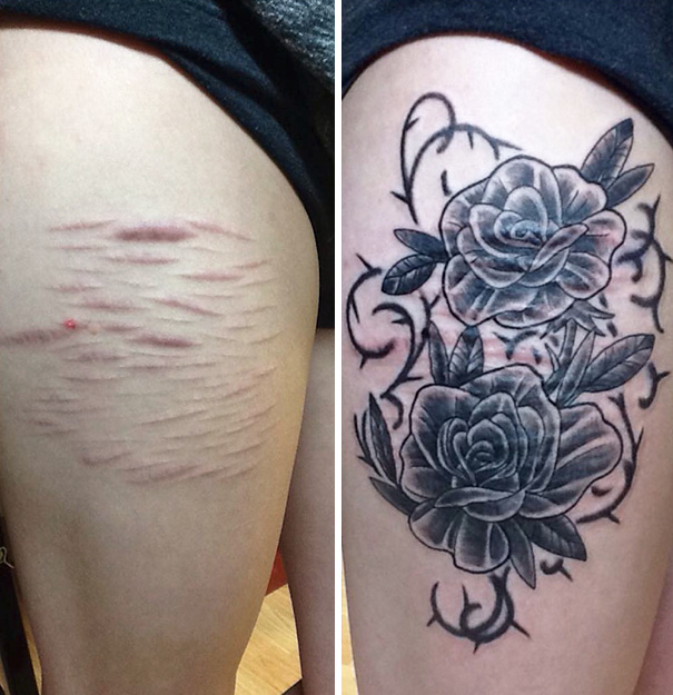 Scars Tattoo Cover Up