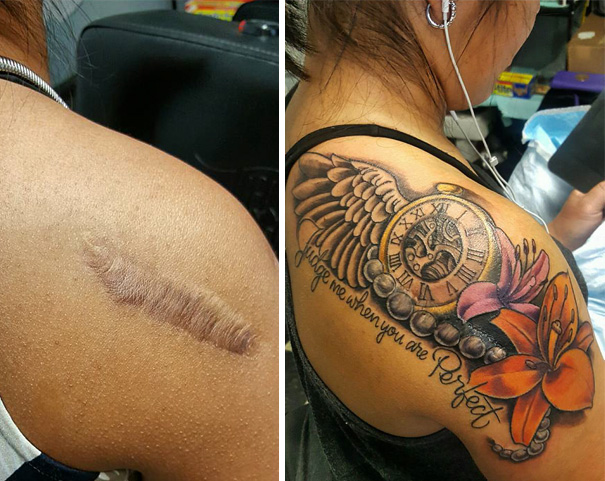 Scar Cover up Tattoo – TATTOOS BANGALORE | ASTRON TATTOOS
