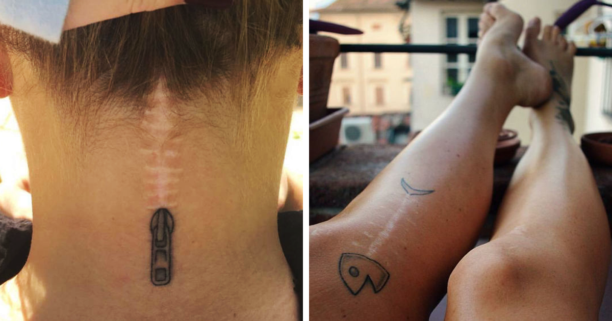211 Amazing Tattoos That Turn Scars Into Works Of Art | Bored Panda