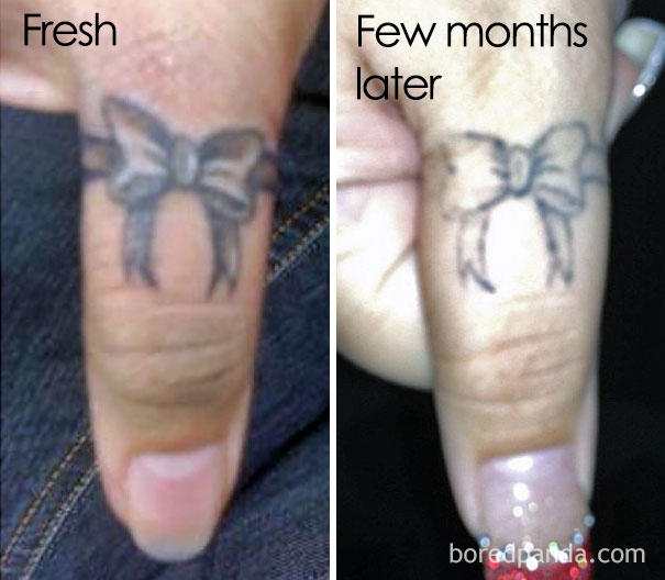 Aging Of A Finger Tattoo