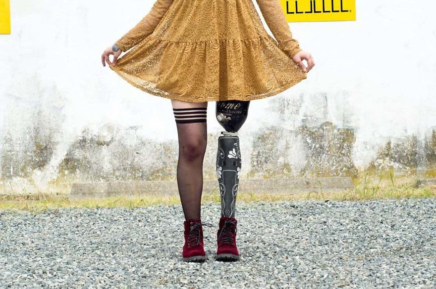 Company Develops Customized Covers To Transform Mechanical Prostheses Into Stylish Accessories