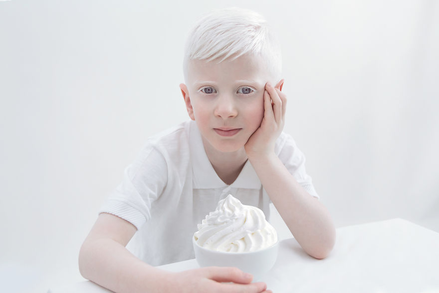 IMG 0034 s Nitay 59529eee0dc6e  880 - A beleza dos albinos