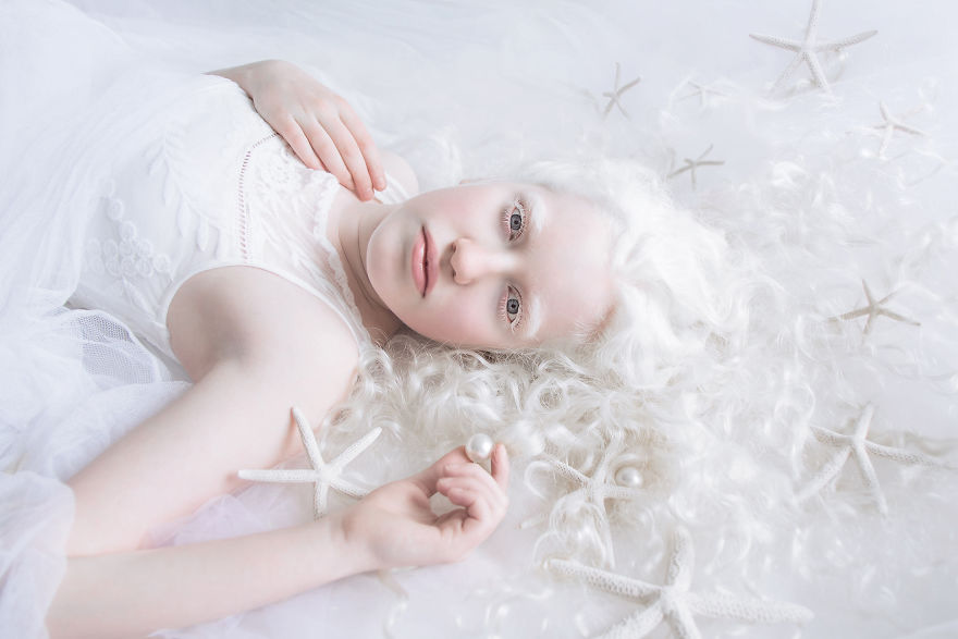 IMG 0065 s Michal 59529efa98b35  880 - A beleza dos albinos