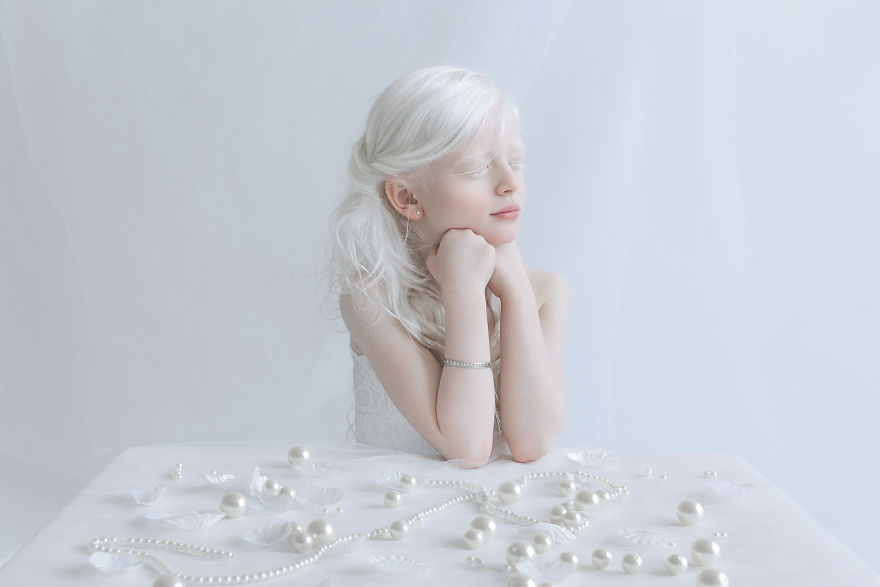 IMG 0495 s Yali 59529f12f099b  880 - A beleza dos albinos