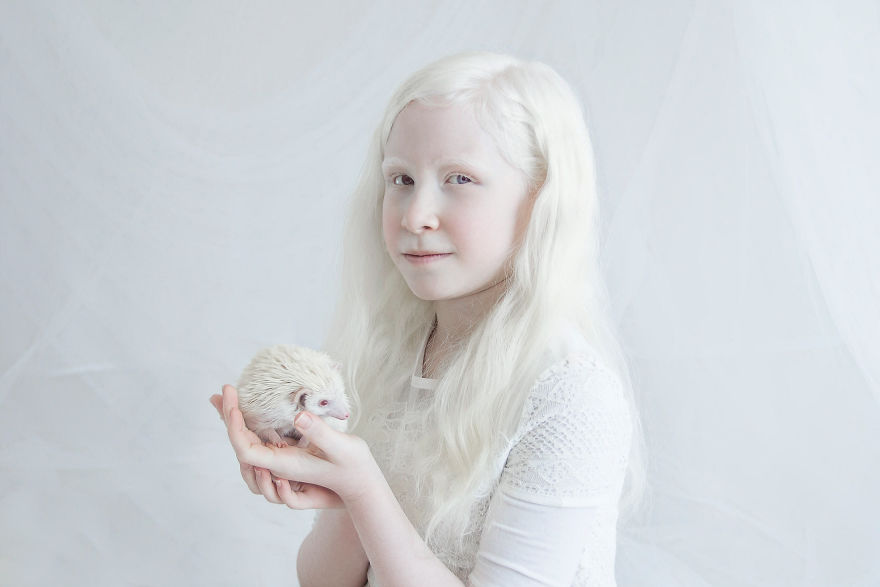 IMG 0685 s Shira 59529f2282380  880 - A beleza dos albinos