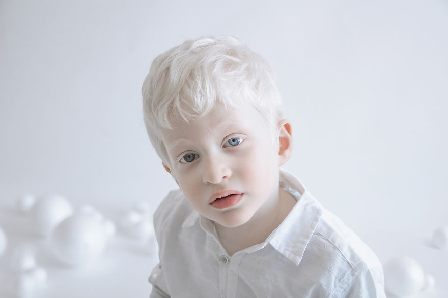 IMG 1201 s Itay 59529f32691db  880 - A beleza dos albinos
