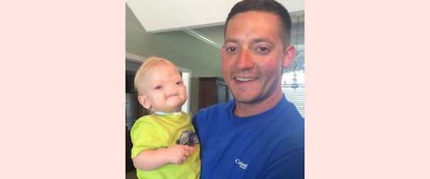 &lsquo;Miracle Baby&rsquo; Born Without A Nose Dies At Age Two