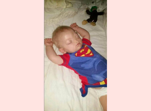 &lsquo;Miracle Baby&rsquo; Born Without A Nose Dies At Age Two