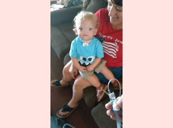 &lsquo;Miracle Baby&rsquo; Born Without A Nose Dies At Age Two