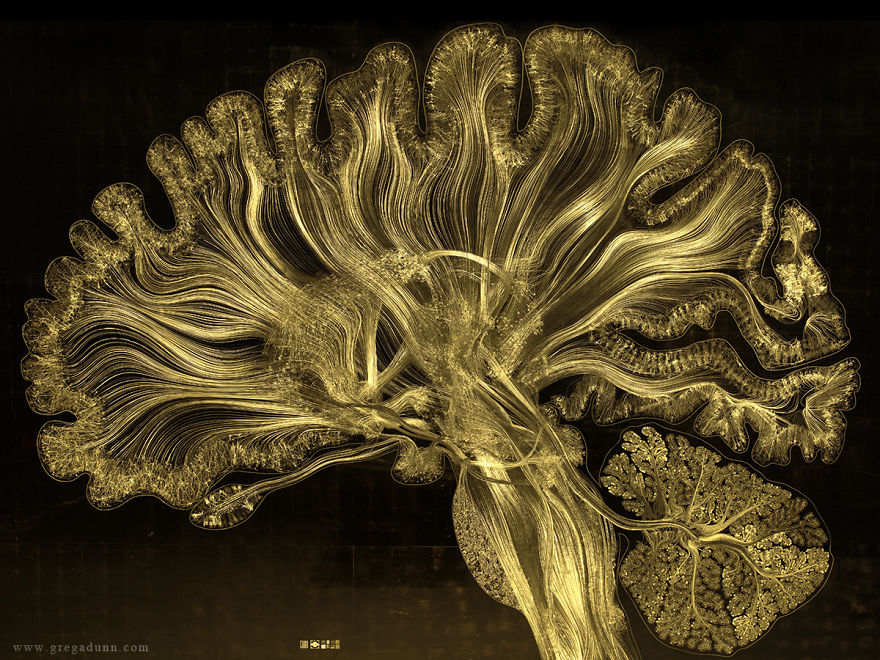Self Reflected: A Snapshot Of The Human Brain Captured By Reflective Microetching
