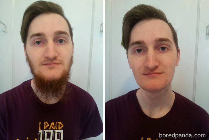 Before & After Of My 7 Month Beard Growth