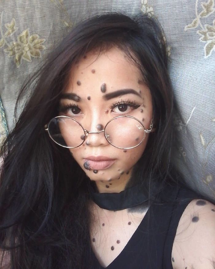 Woman Who Was Called A Monster For Her Head-To-Toe Hairy Moles Might Be The Next Miss Universe