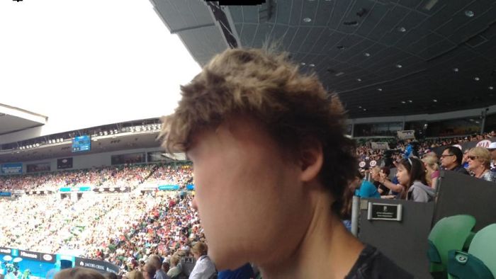 My Friend Took A Panoramic, This Happened To My Face