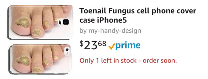 Toenail Fungus Cell Phone Cover Case iPhone5