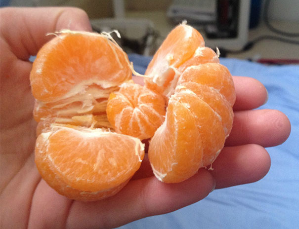 There Was A Mini Orange Inside My Orange