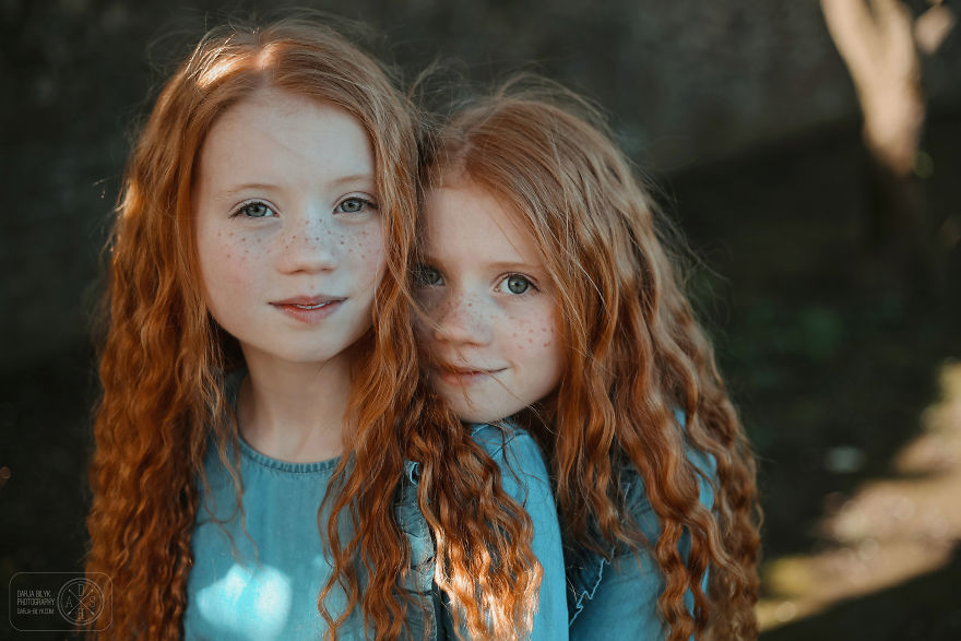 10 Pictures Of Ginger Twins I Took In Scotland