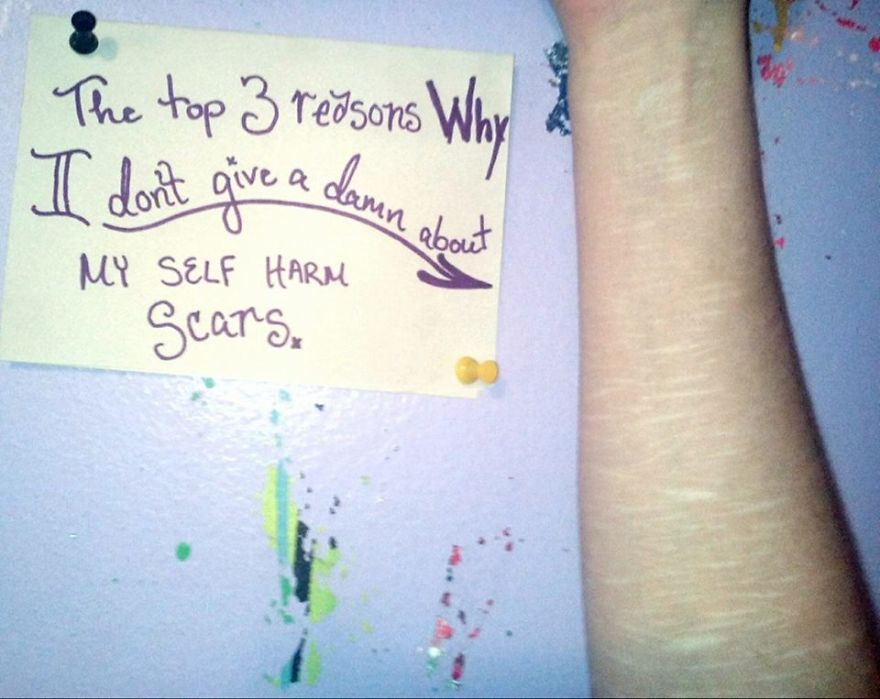 Three Reasons Why I Don't Give A Damn About My Self-Harm Scars