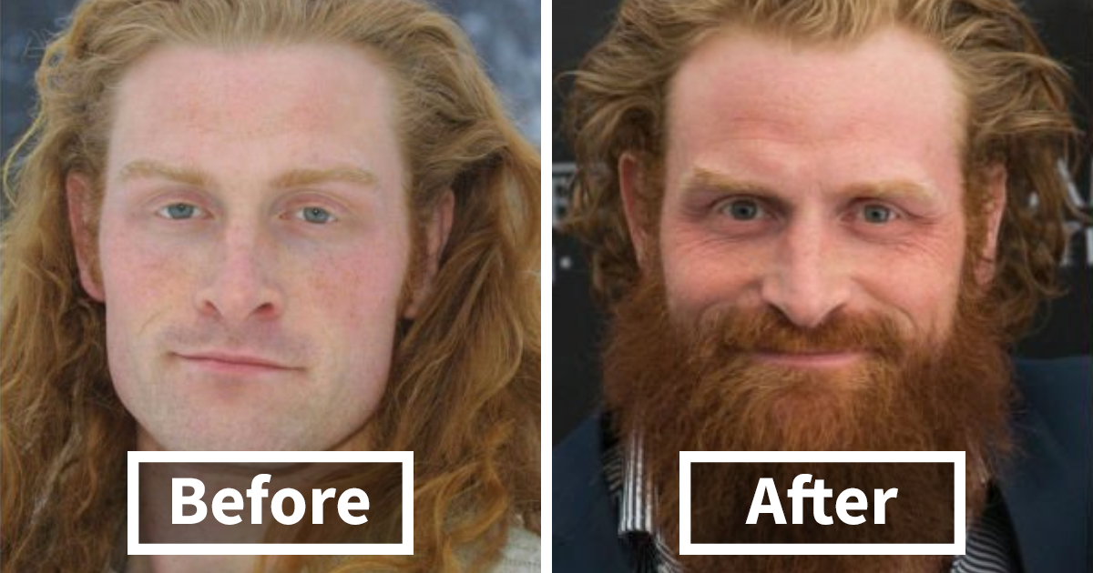 62 Before & After Pics That Prove Men Look Better With Beards | Bored Panda