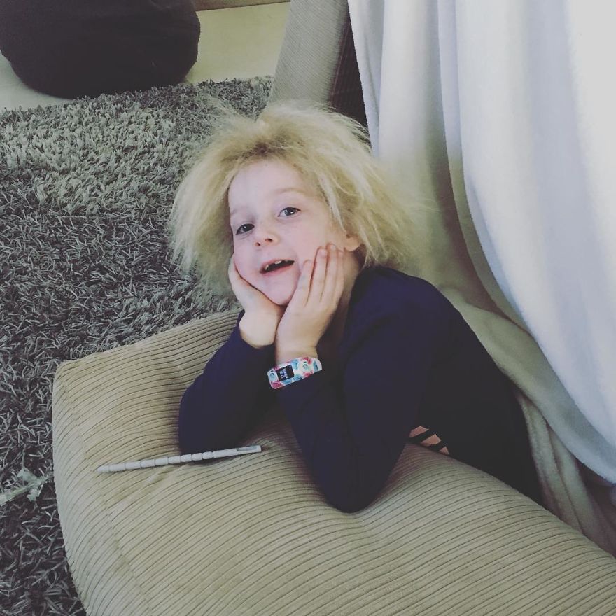 Meet The Rare Syndrome That Leaves The Girl's Hair Totally Wild, Literally Unthinkable