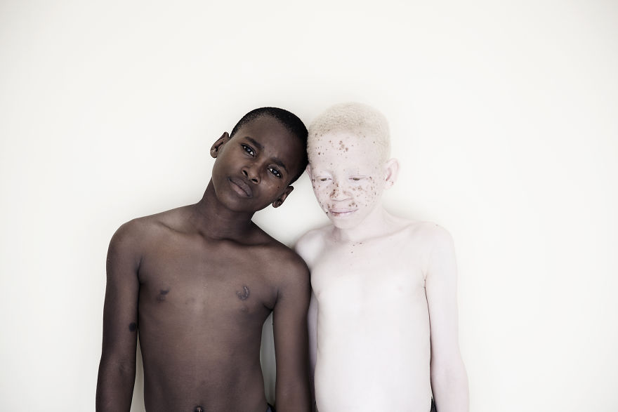 Stunning Photos Show The Beauty Of Albino Children To Raise Awareness Of Their Heartbreaking Situation In Tanzania