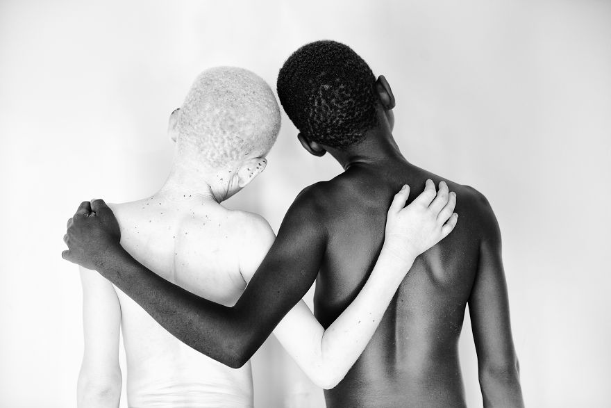 Stunning Photos Show The Beauty Of Albino Children To Raise Awareness Of Their Heartbreaking Situation In Tanzania