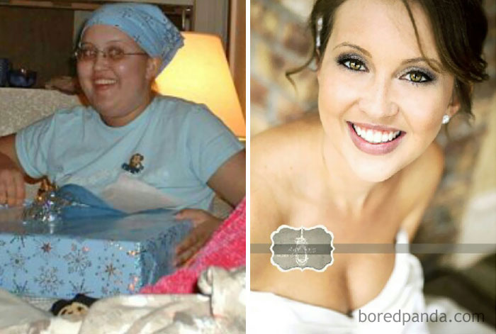 10 Years Cancer Free! 12 To 22-Years-Old, In The Midst Of Death, To My Wedding Day