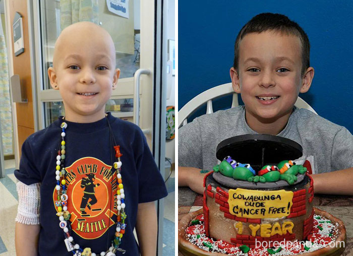 Ethan Is 1 Year Cancer Free