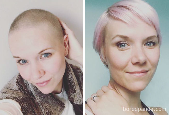 Chemo Hair Is A Funny Old Thing, You Are So Desperate To Get Locks On Your Baldie But Every Few Months You Need To Learn How To Style A New Do