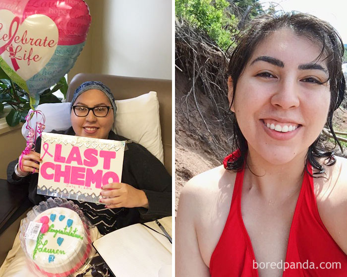 It Has Been One Year Since My Last Chemo. So It's Been One Year Of Hair Growth As Well