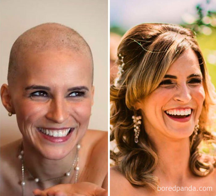 Same Smile 2 Years Apart, One During Chemo And The Other On Our Wedding Day! Happy To Be Cancerfree For 2 Years Now, 3 More To Go!