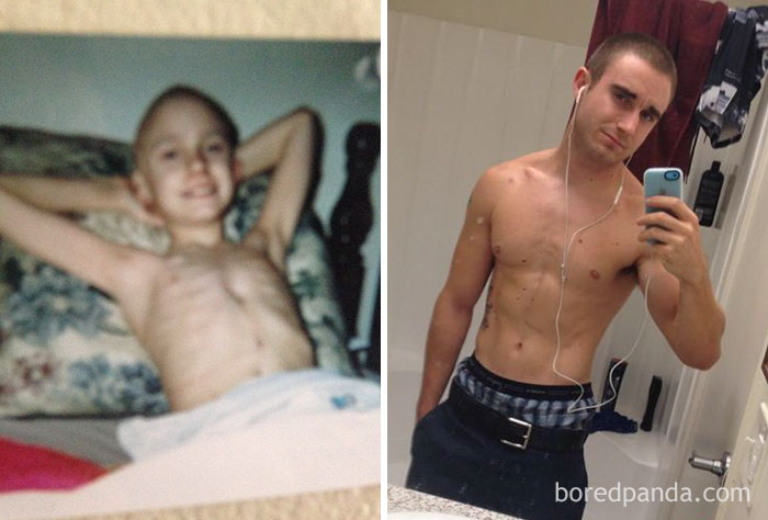 Then And Now, Cancer Made Me Who I Am. I've Come So Far. The Pain And Memories Are Still There But I'm Stronger Now