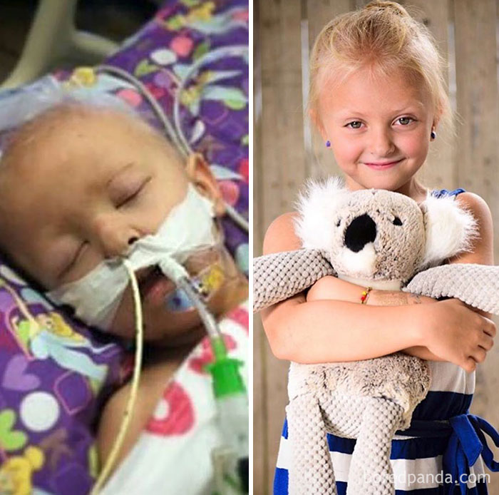 Seven Year Old Claire Has Come Such A Long Way, And We Couldn't Be More Proud Of Her. She Fought Ewing's Sarcoma And Won! Cancer Messed With The Wrong Girl