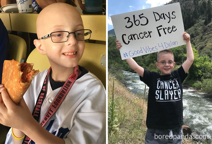 Dylan Has Been N.E.D. (No Evidence Of Disease) And Cancer Free For 1 Entire Year. It Is His "Cancerversary"