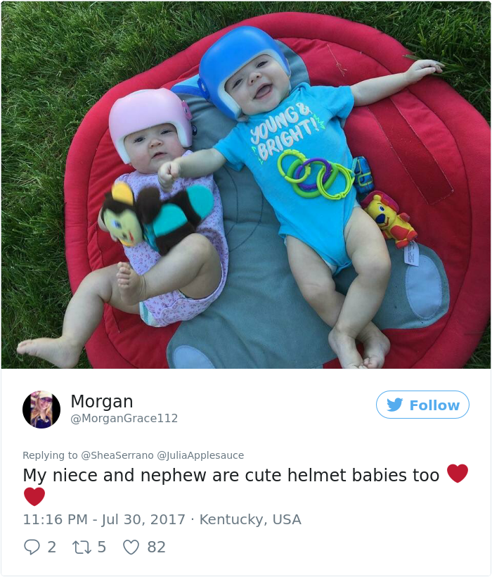This Baby Has To Wear A Helmet So The Whole Family Decides To Step In
