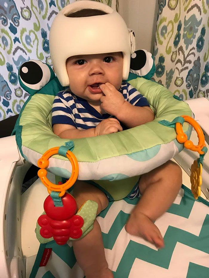Este bebé necesita llevar casco, así que toda la familia decide acompañarlo