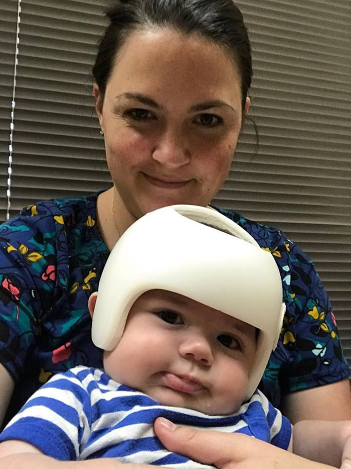 Este bebé necesita llevar casco, así que toda la familia decide acompañarlo